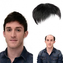 Human Hair Men Wig For Hair Loss Alopecia Solutions